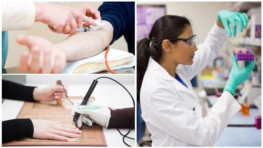 Metode de diagnostic pentru detectarea paraziților în organism