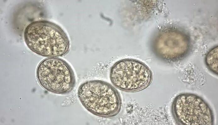 paraziți la microscop