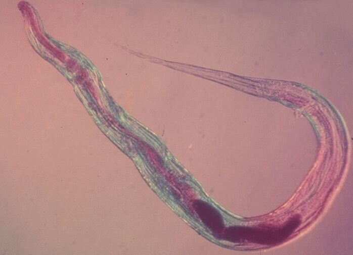 Oxiuri sub microscop