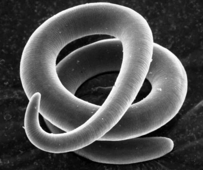 Trichinella la microscop